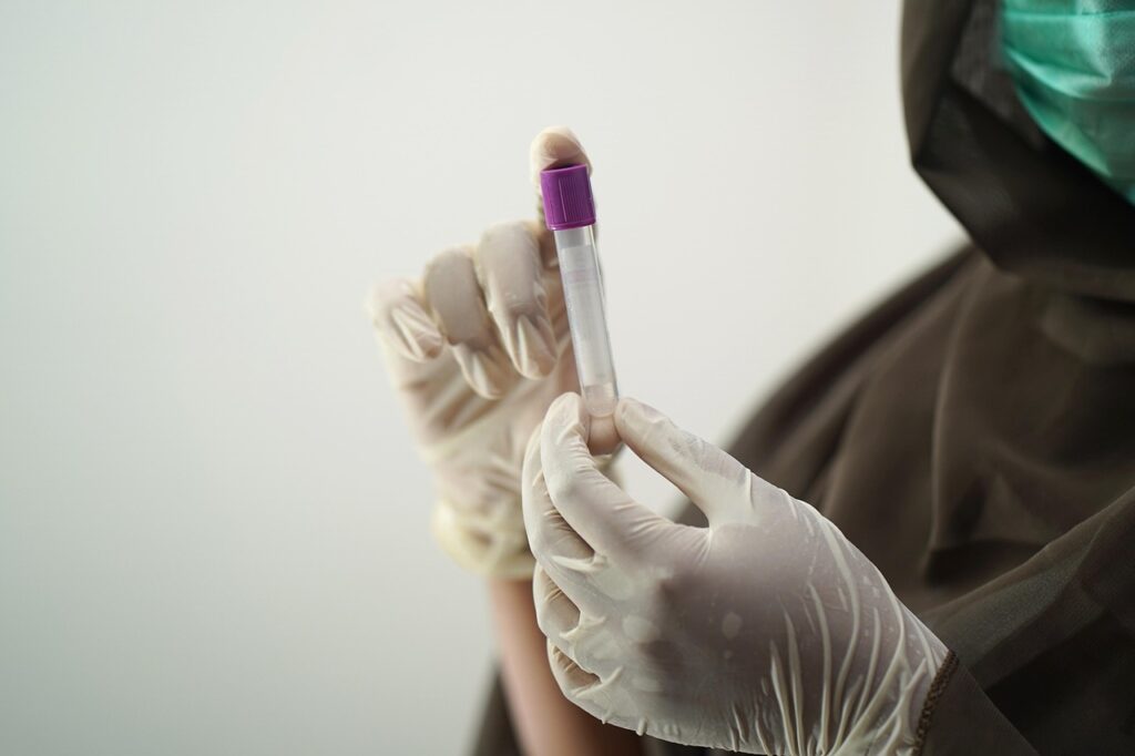 blood test, blood sample, medical technology, medical technologist, surgical gloves, face mask, sample, hospital worker, laboratory, lab, blood test, blood test, blood test, blood test, blood test, sample, laboratory, laboratory, laboratory, lab, lab