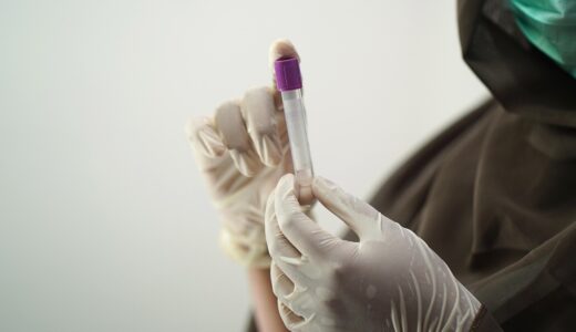 blood test, blood sample, medical technology, medical technologist, surgical gloves, face mask, sample, hospital worker, laboratory, lab, blood test, blood test, blood test, blood test, blood test, sample, laboratory, laboratory, laboratory, lab, lab