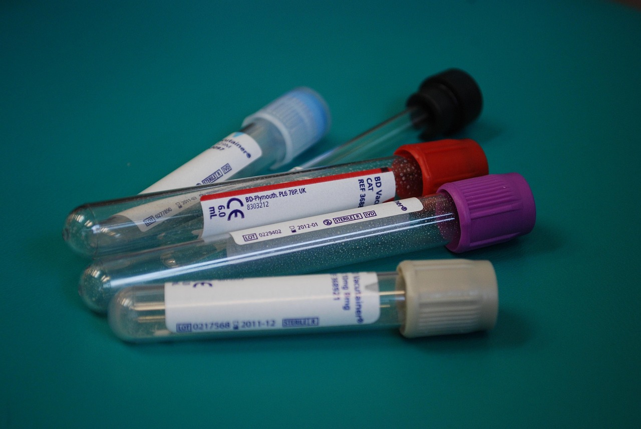 lab, medical, diagnostics, test tube, glove, diagnostician, medic, tests, diagnosis, test, the doctor, hospital