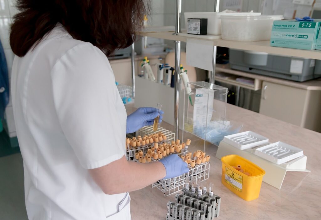 lab, analysis, diagnostics, hospital, test tube, test, tests, medical, the doctor, test tubes, medic, treatment, patient, diagnostician, health